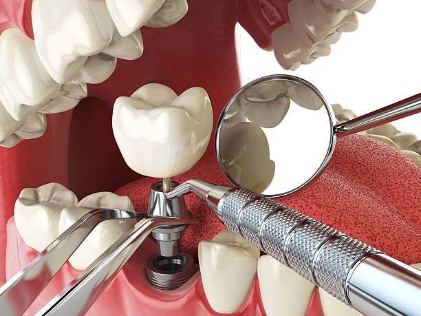 Best Emergency Dentist for Knocked-Out Tooth in South Ack, NY